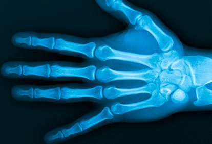 Röntgenaufnahme Hand